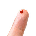 Finger mit Bluttropfen