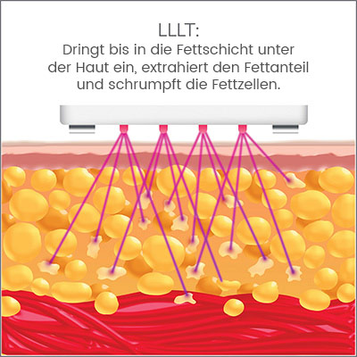 Erklärende Infografik zur Wirkung von LLLT in Farbe Erklärende Infografik zur Wirkung von LLLT in Farbe