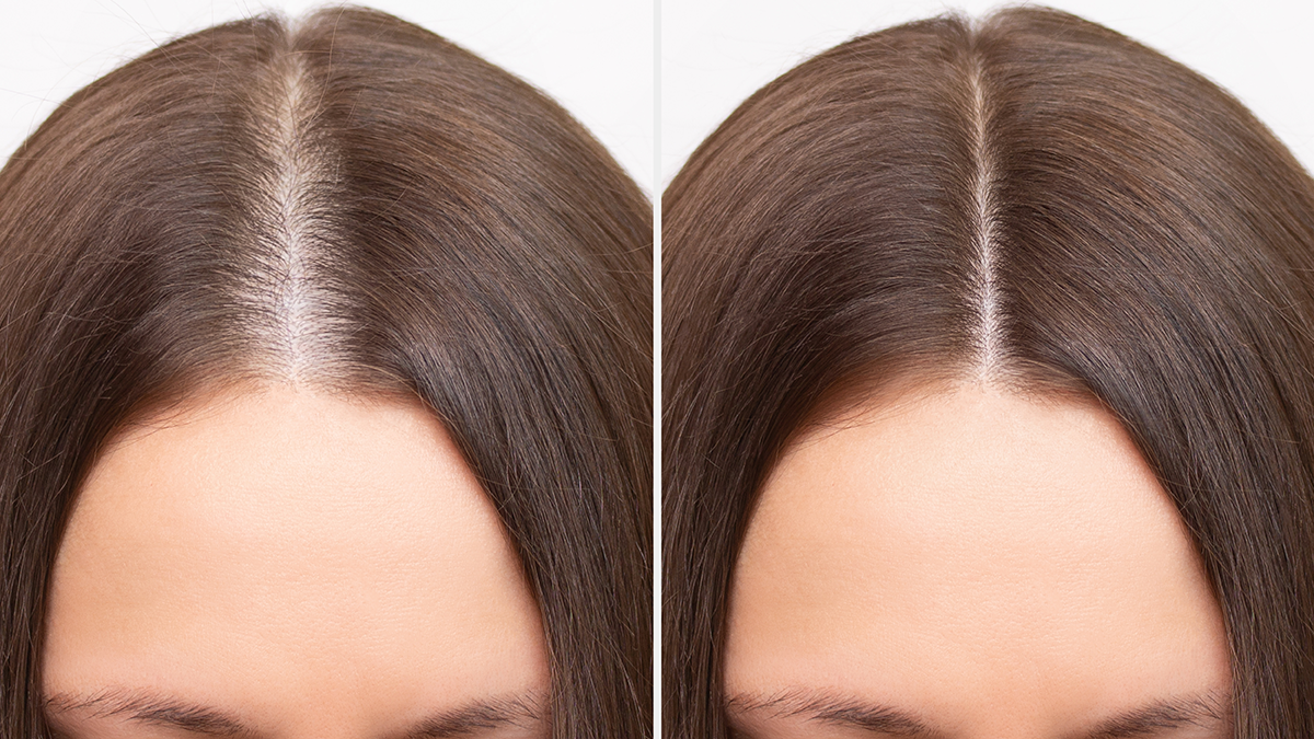 Krillöl stärkt gerade gesundes, glänzendes Haar