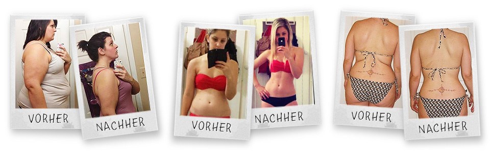 Drei vorher-nachher-Bilder zeigen einen Gewichtsverlust Drei vorher-nachher-Bilder zeigen einen Gewichtsverlust